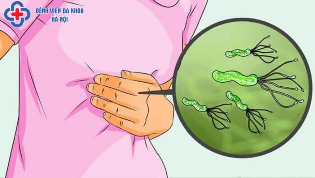 ăn ngoài quán bị vi khuẩn hp - Hình 5