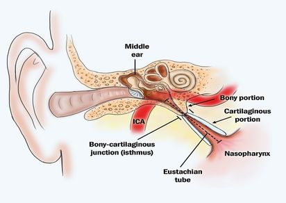 Đi máy bay bị ù tai phải làm sao - Hình 4