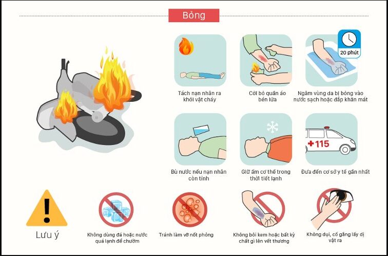 Làm gì khi bị bỏng