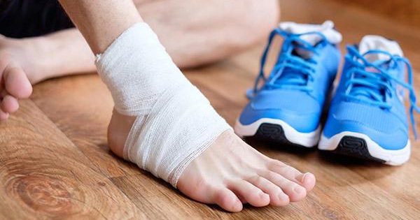 Làm gì khi bị chấn thương nhẹ khi du lịch - Hình 5
