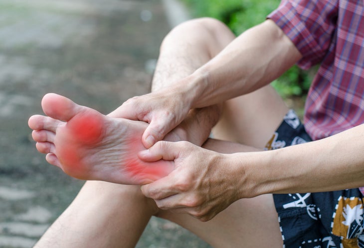 Làm gì khi bị đau chân do đi bộ nhiều