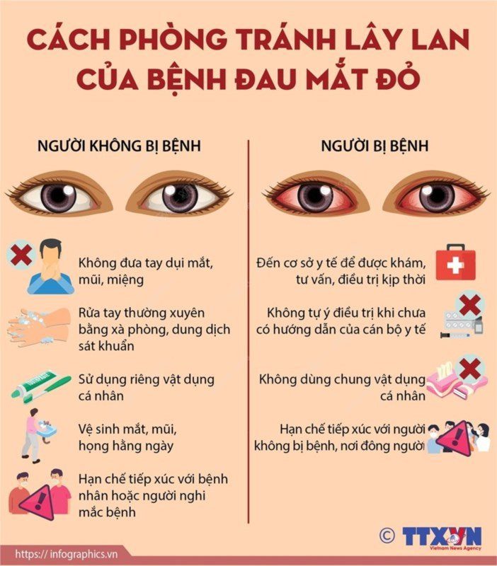 Làm gì khi bị đau mắt khi đi du lịch - Hình 3