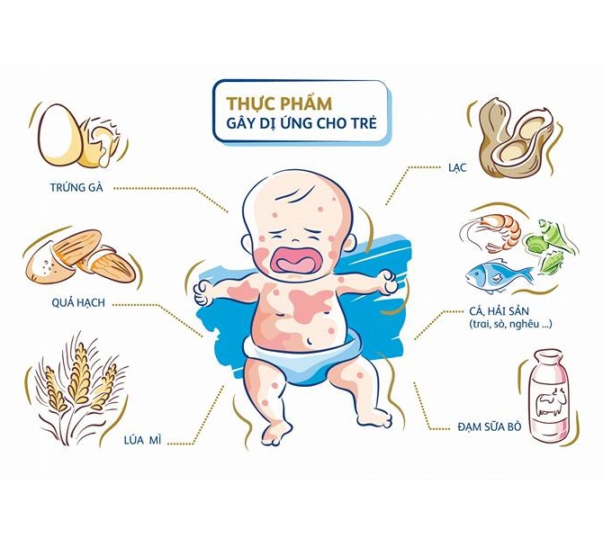 Làm gì khi bị dị ứng thực phẩm - Hình 5