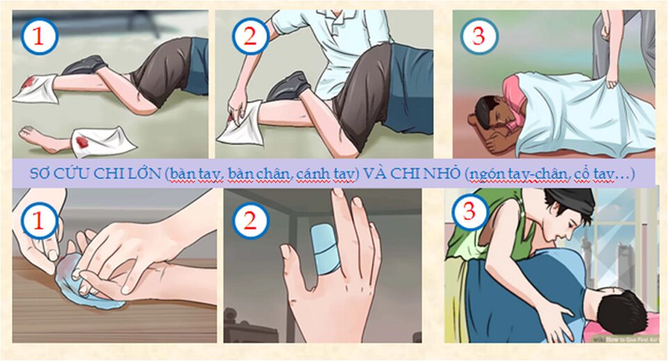 Làm gì khi bị đứt tay khi đi du lịch - Hình 4