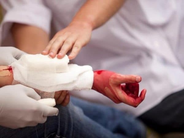 Làm gì khi bị đứt tay khi đi du lịch - Hình 5