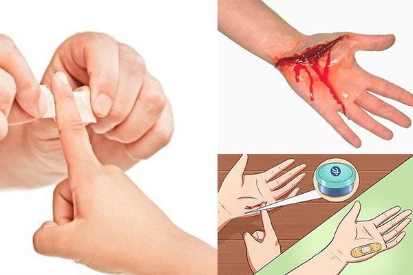 Làm gì khi bị đứt tay khi đi du lịch
