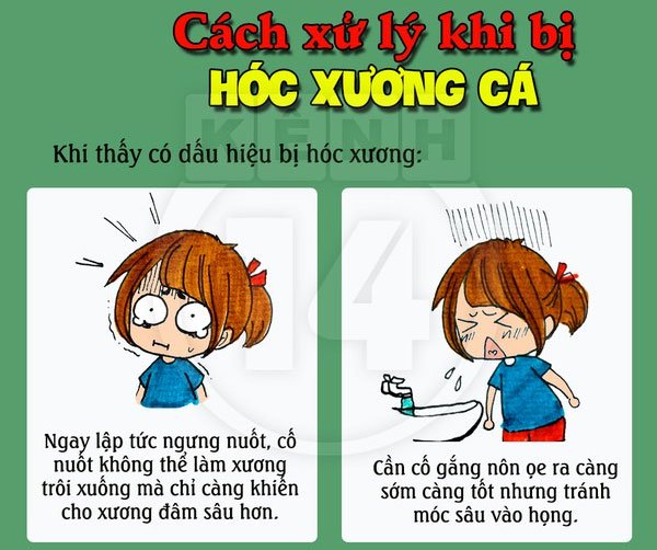 Làm gì khi bị hóc xương cá - Hình 2