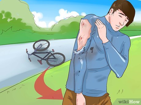 Làm gì khi bị trầy xước khi leo núi - Hình 4