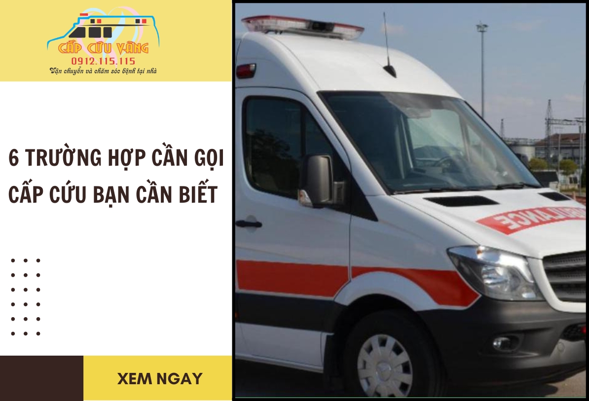 Làm gì khi cần gọi cấp cứu ở địa phương - Hình 3