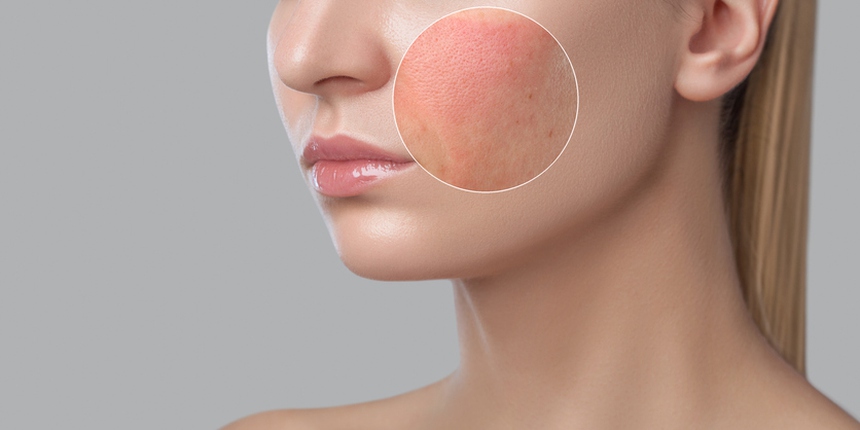 Làm gì khi gặp gió mạnh trên đèo - Hình 2
