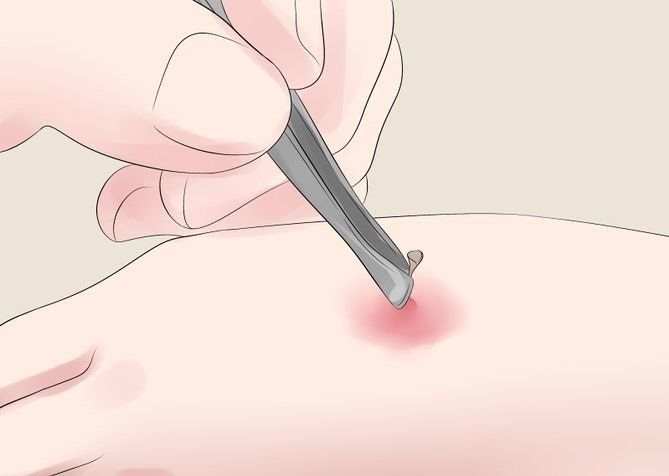 Làm gì khi gặp ong - Hình 3
